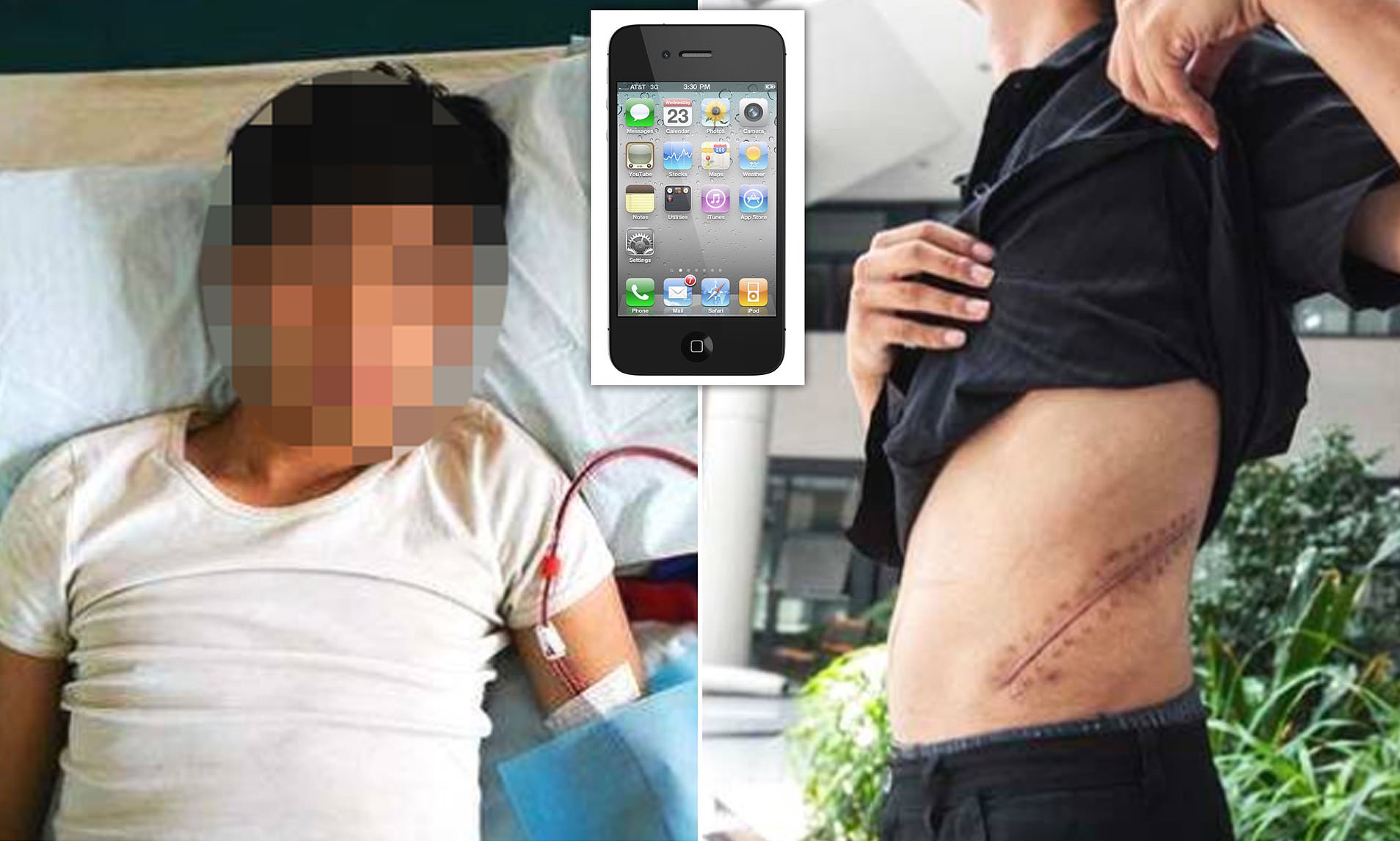 SHOCKING: Teen Who Sold His Kidney For iPhone Is Now Bedridden For Life
