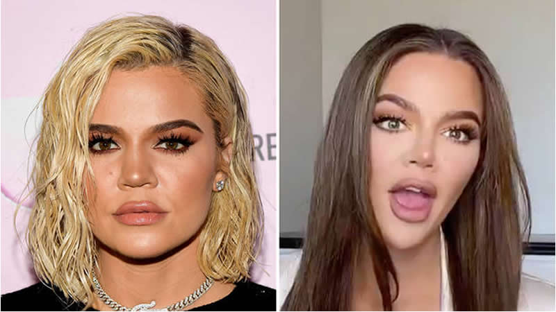 Khloé Kardashian Opens Up Plastic Surgery Behind Her ‘New Face’