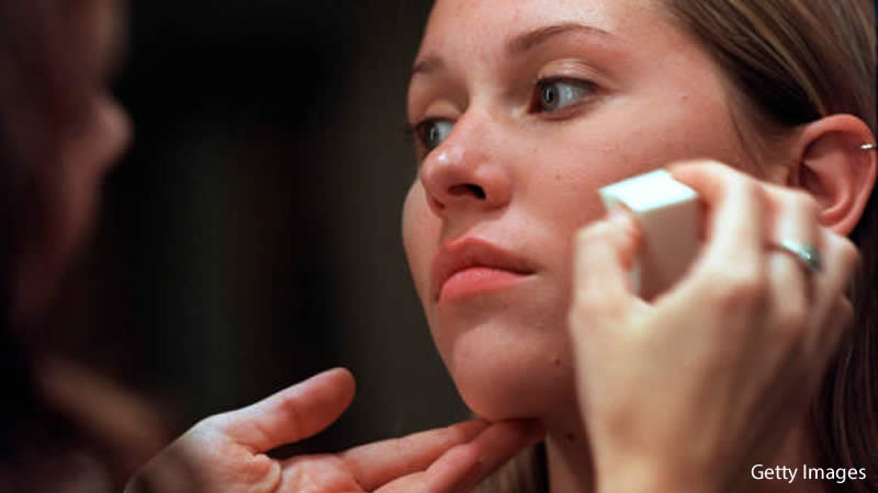 Myths Should Stop Believing About Acne