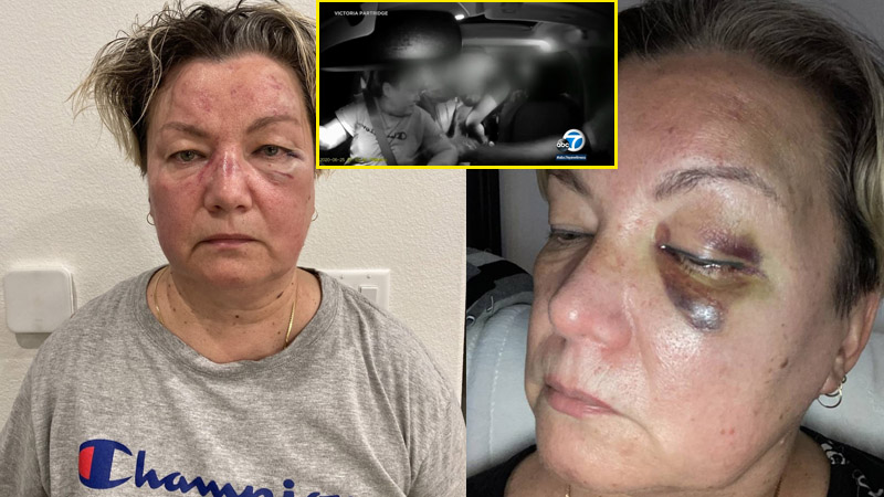Las Vegas Uber driver attacked