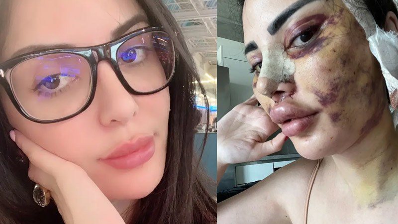 Woman who paid $600,000 to turn herself into Kim