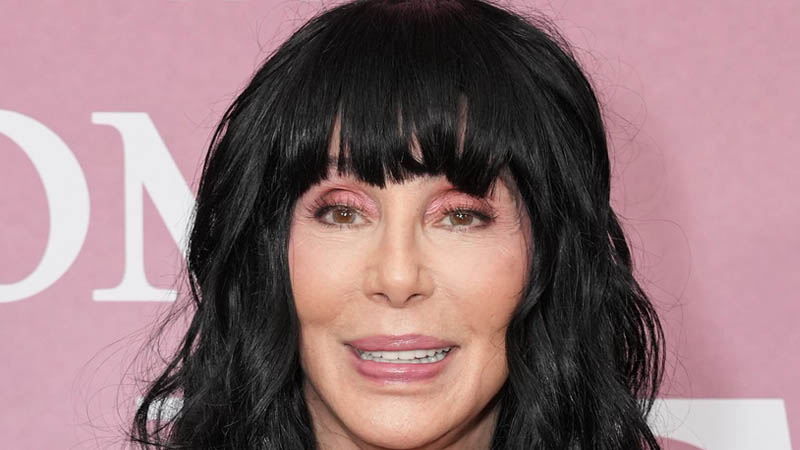 Cher facelift