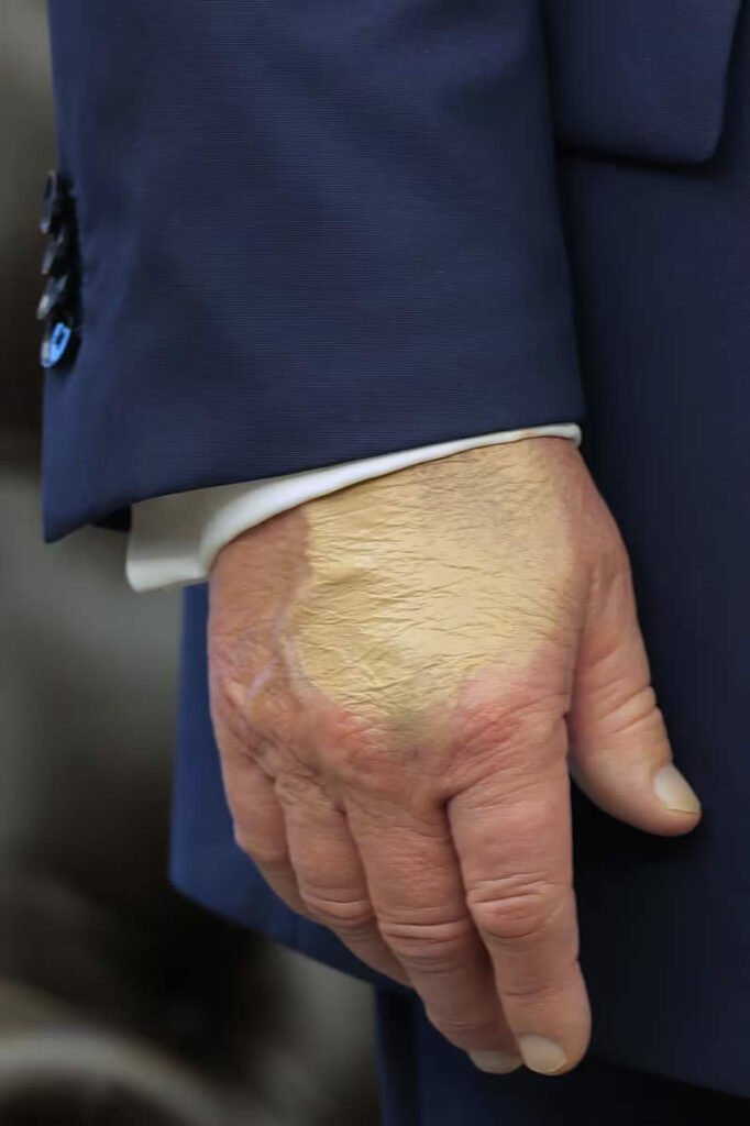 Trump Mystery hand make-up
