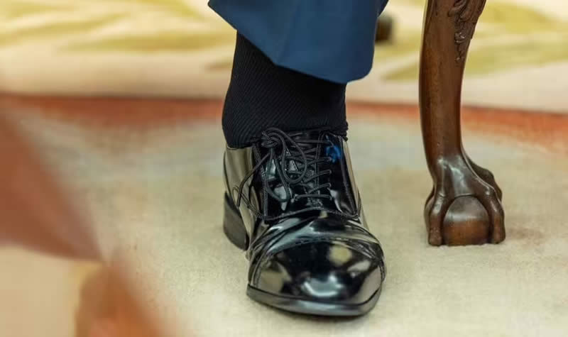 Trump Swollen ankles