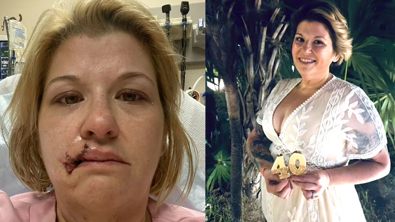 Woman hospitalized after being attacked by family dog at Indiana Home: ‘found her lip on the bedroom floor’