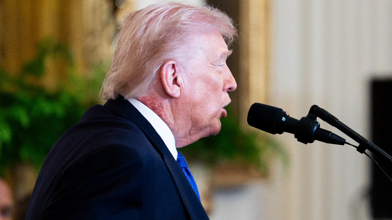 Trump’s Neck Rash Steals Attention